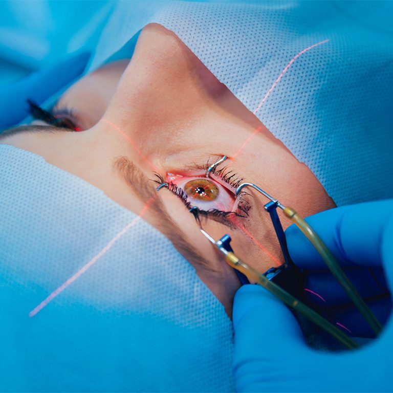 Eye-Surgeries-istanbul