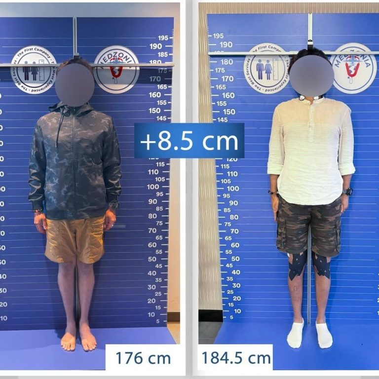 WhatsApp Görsel 2025-03-11 saat 12.32.51_f30e1c25