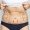 closeup-womans-belly-with-excess-fat-with-marking-her-body-liposuction-plastic-surgery