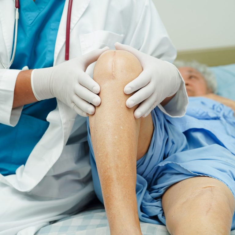 Doctor checking Asian elderly woman patient with scar knee replacement surgery in hospital.