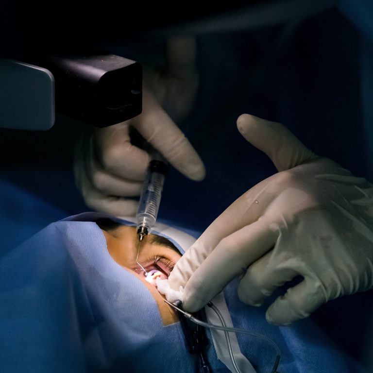 Patient and team of surgeons in the operating room during ophthalmic surgery. Eluma of the century. Lasik treatment. Patient under sterile cover