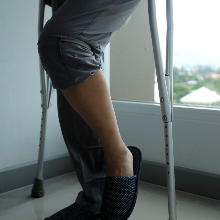 Physiotherapist is doing physical therapy for a patient, the patient has body aches due to overwork and has undergone treatment and physiotherapy with a professional physiotherapist.