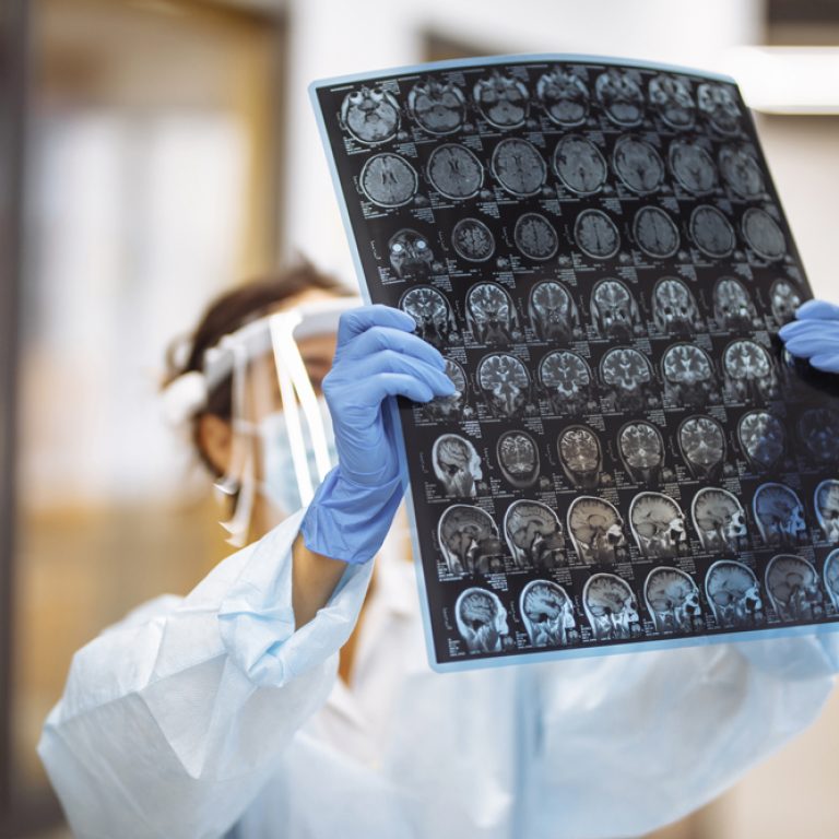woman-doctor-is-checking-brain-mri-x-ray-image-patient-hospital-female-medical-worker-wearing-protective-mask-white-gown-corridor-hospital-heath-medicine-concept
